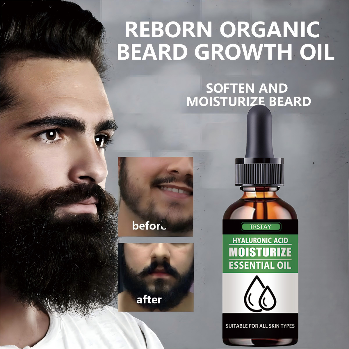 Hair Care Essence Oil Spray - Men Beard Growth Roller Set Beard