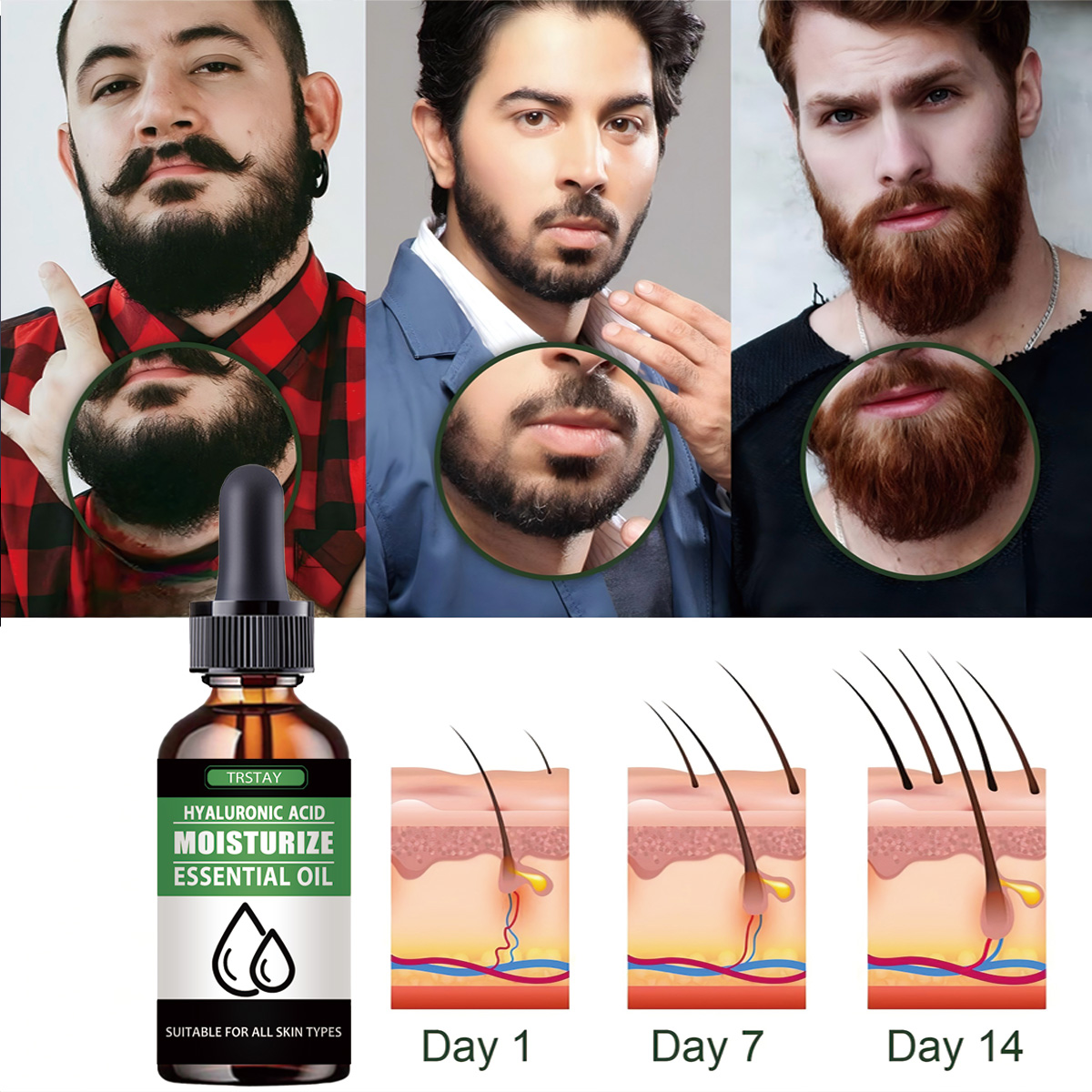 Men Beard Growth Roller Set Be - Hair Care Essence Oil Spray reseña y precio