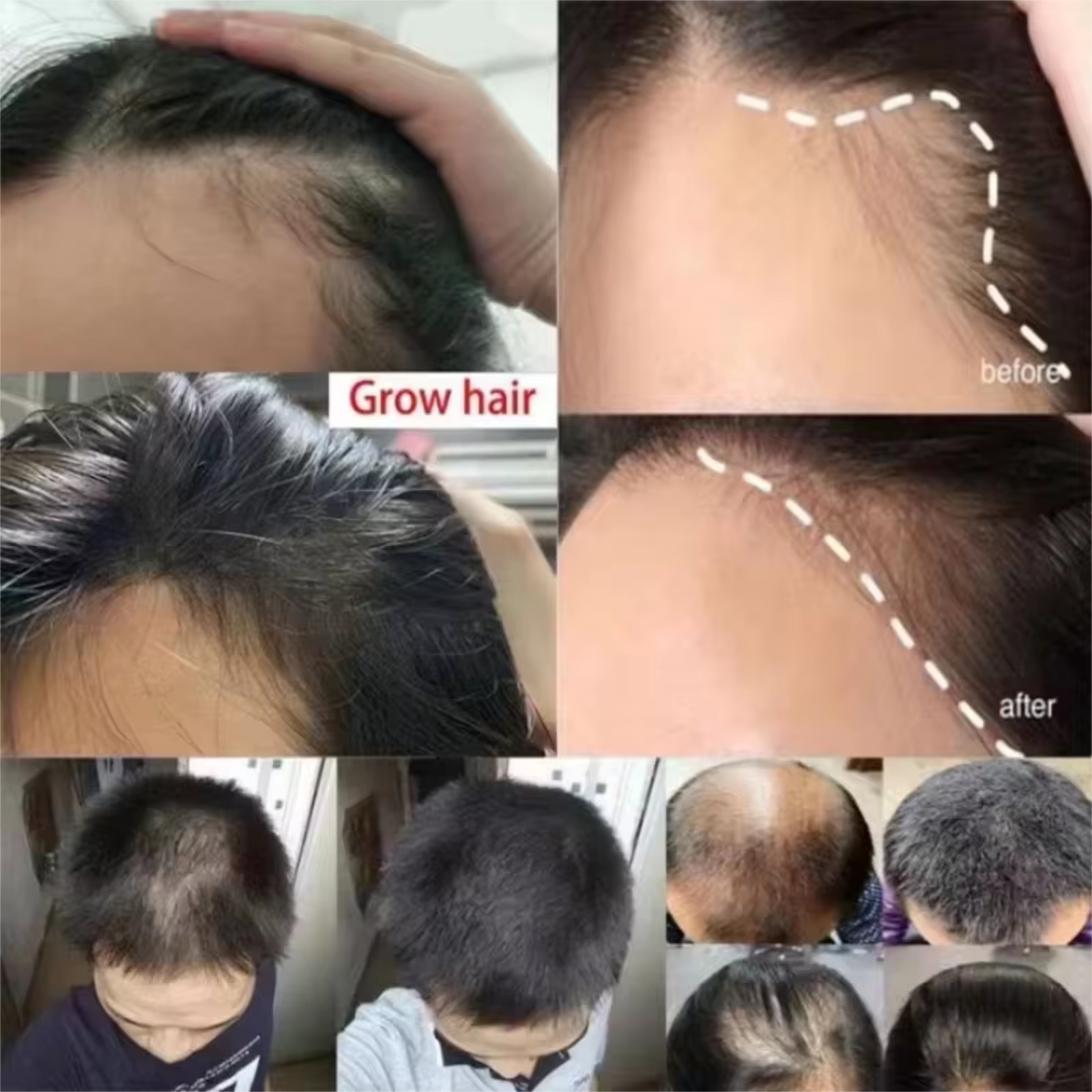 Batana Oil Hair Growth Serum S - Hair Care Essence Oil Spray reseña y precio