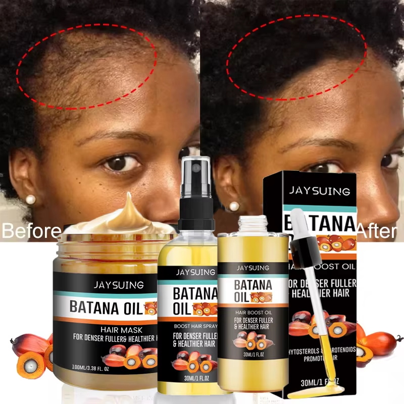 Batana Oil Thick Hair Serum Sp - Hair Care Essence Oil Spray reseña y precio