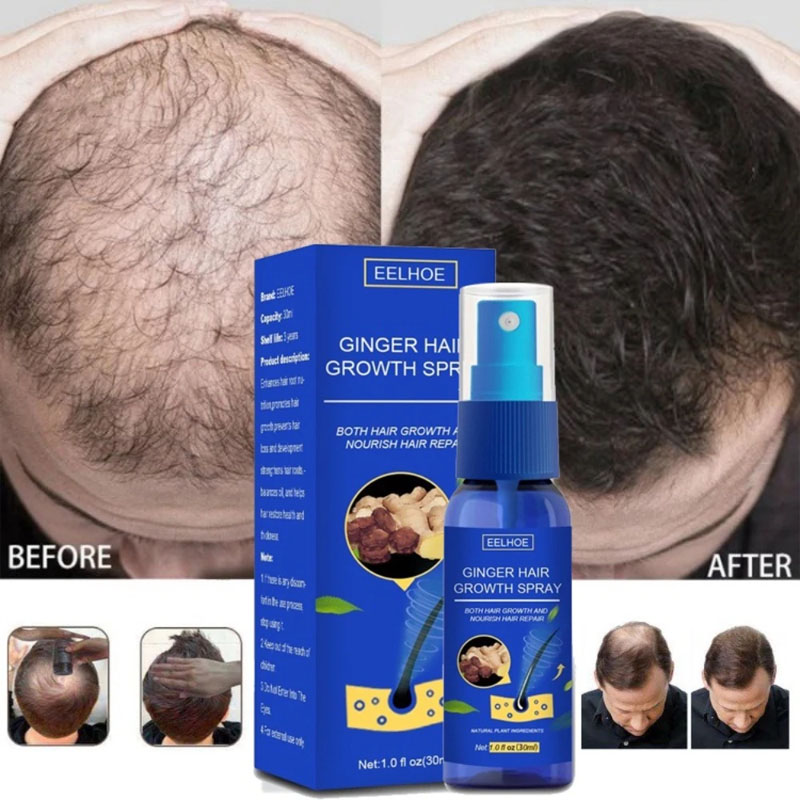 Ginger Hair Growth Serum Spray - Hair Care Essence Oil Spray reseña y precio