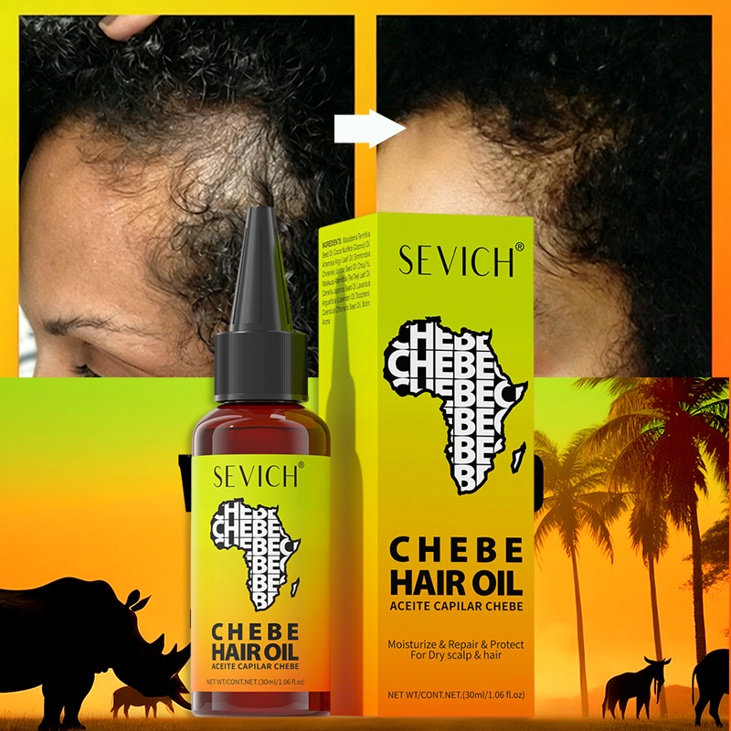 Chebe Hair Growth Oil Anti-Hai - Hair Care Essence Oil Spray reseña y precio