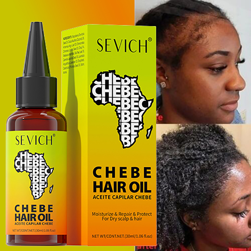 Chebe Hair Growth Oil Anti-Hai - Hair Care Essence Oil Spray reseña y precio