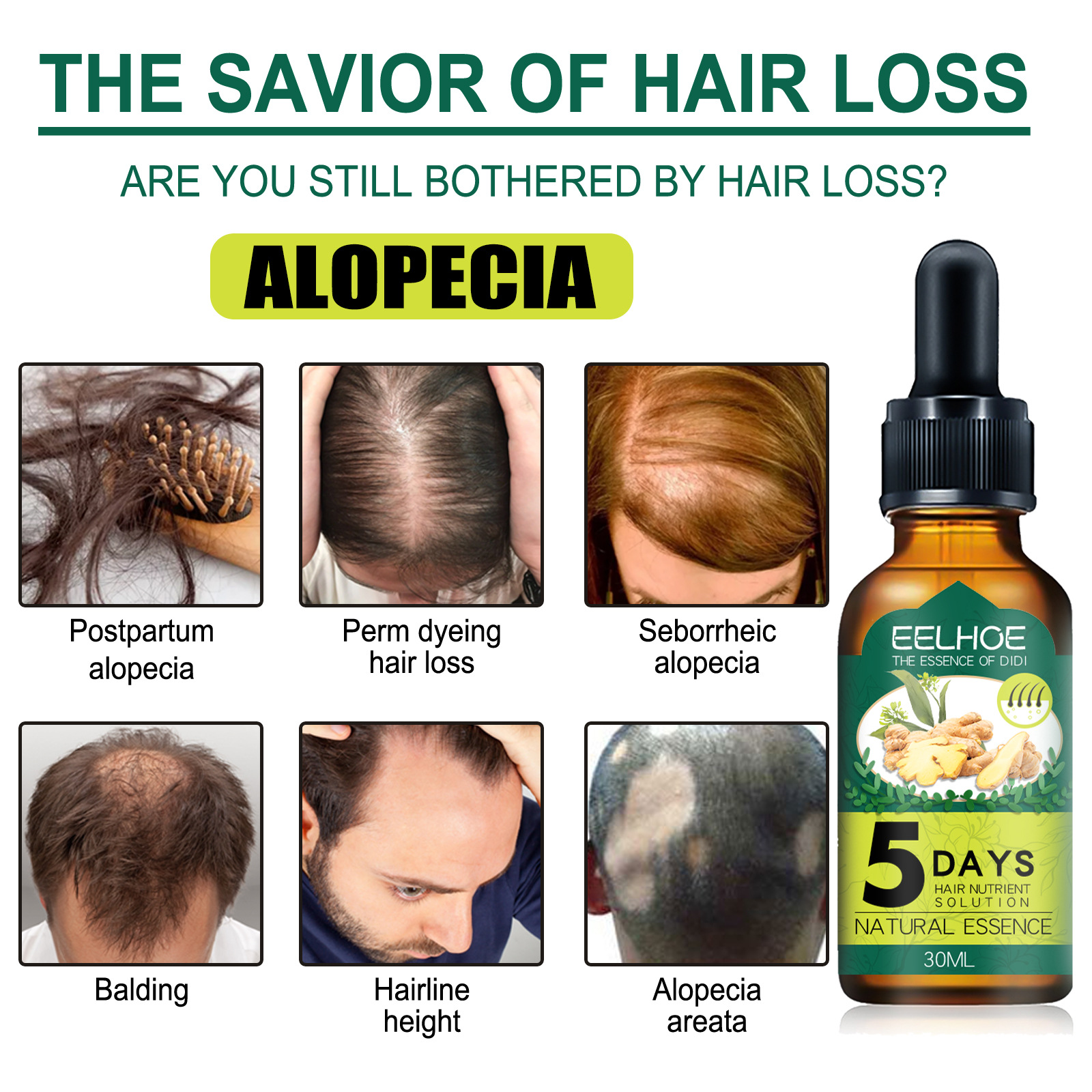5Days Ginger Scalp Serum Dropp - Hair Care Essence Oil Spray reseña y precio
