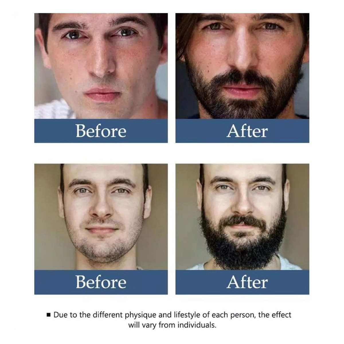 Natural Beard Growth Oil Organ - Hair Care Tonic reseña y precio
