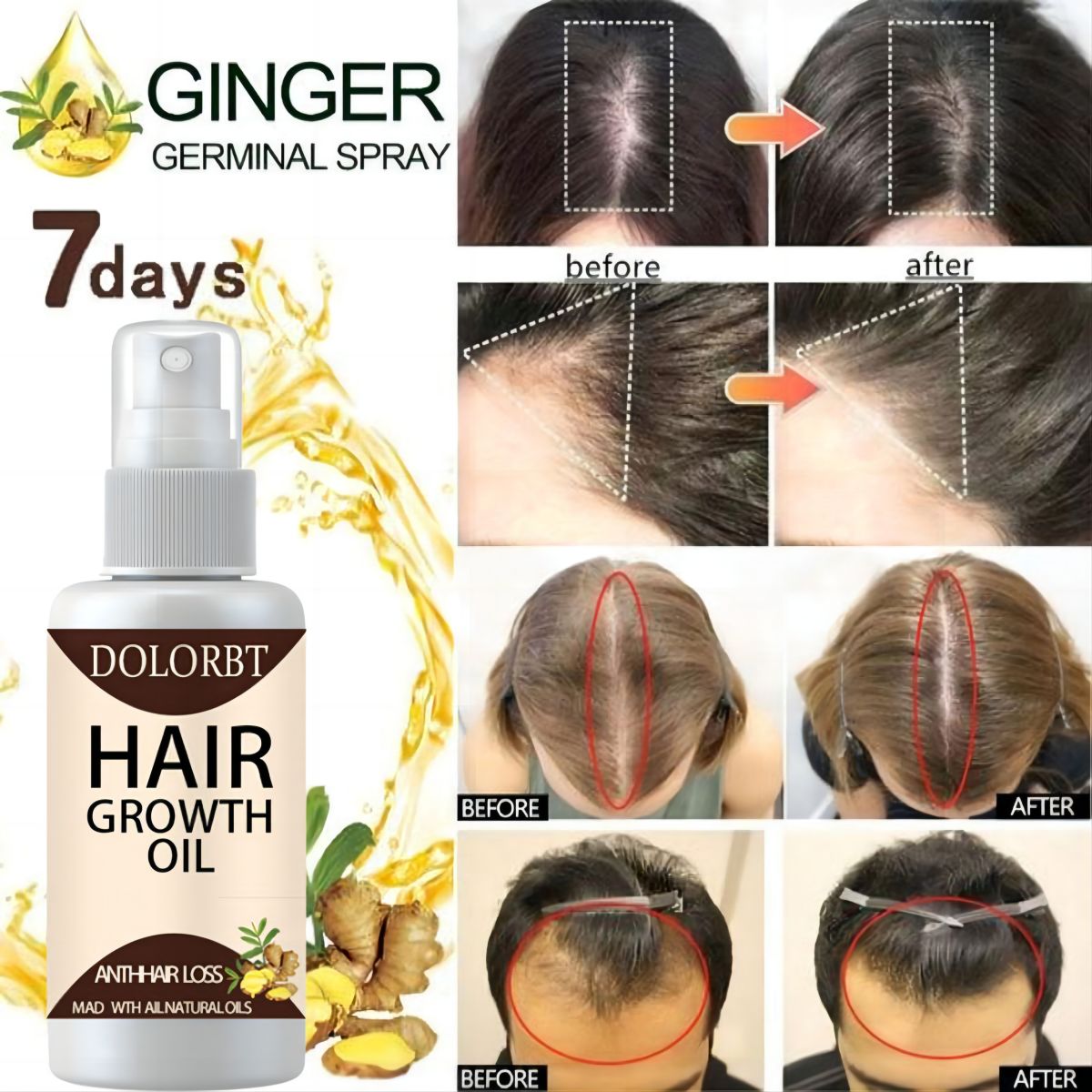 Hair Growth Essence Oil Spray  - Hair Care Essence Oil Spray reseña y precio