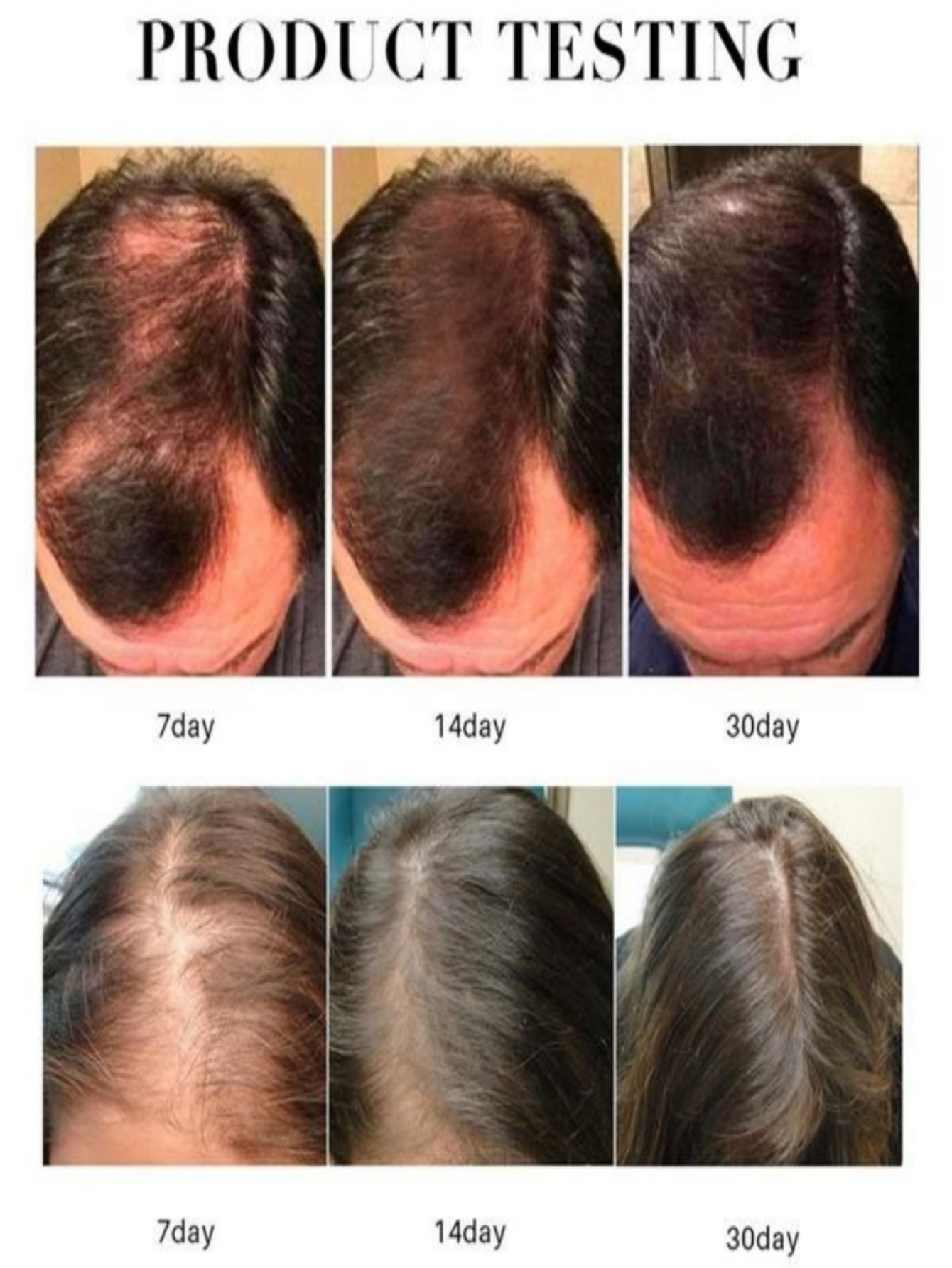 Hair Growth Essence Oil Spray  - Hair Care Essence Oil Spray reseña y precio