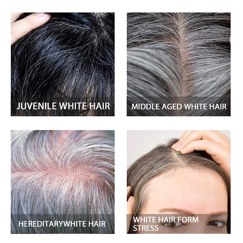 White Hair Treatment Darkening - Hair Care Essence Oil Spray reseña y precio