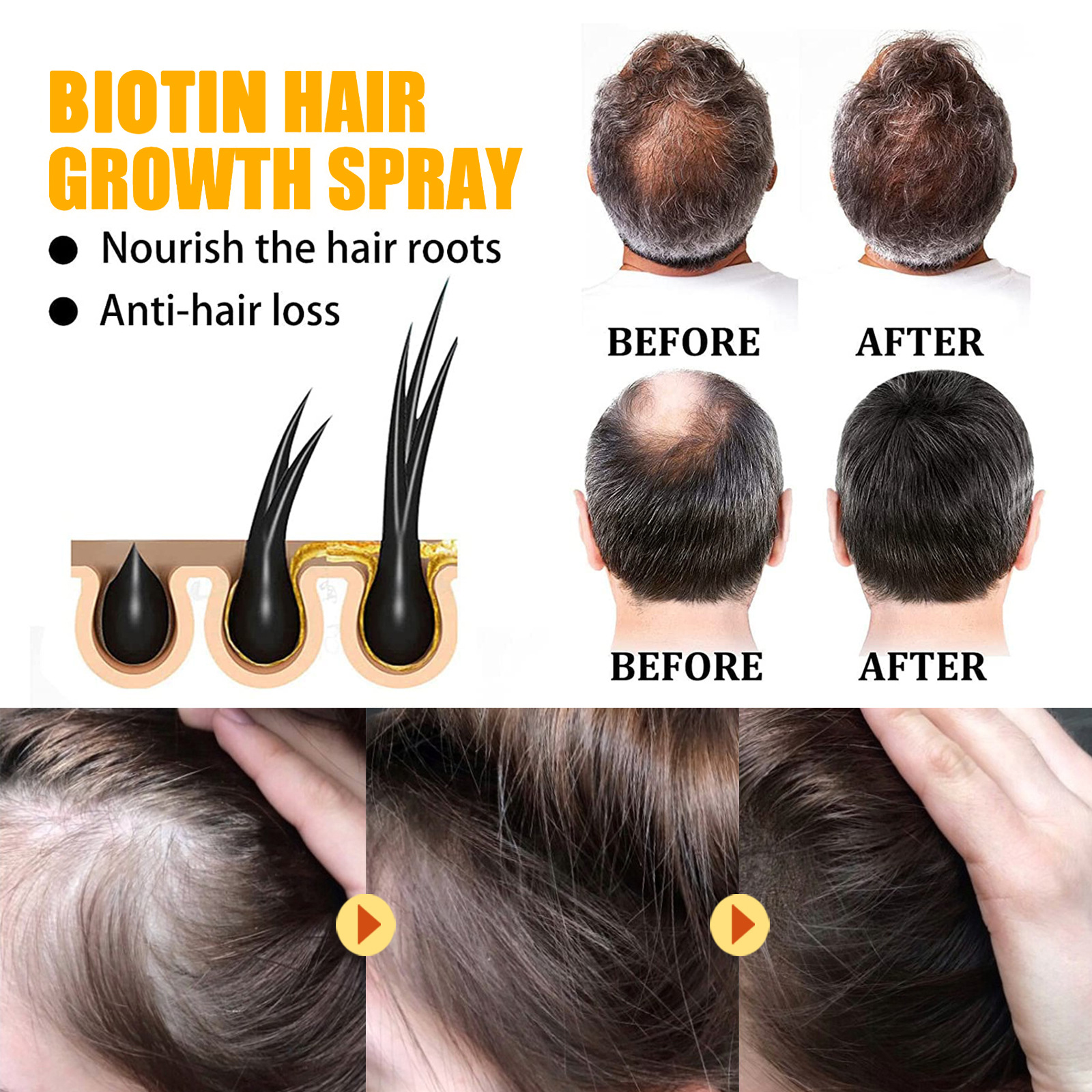 Biotin Hair Care Spray Nourish - Hair Care Essence Oil Spray reseña y precio